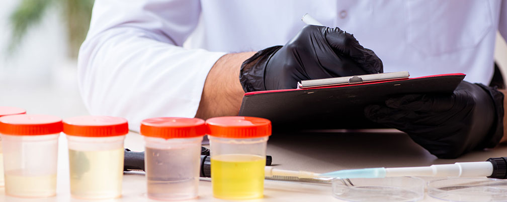 Order Rapid Urine and Saliva Drug Screening Kits