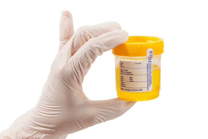 Urine Drug Testing
